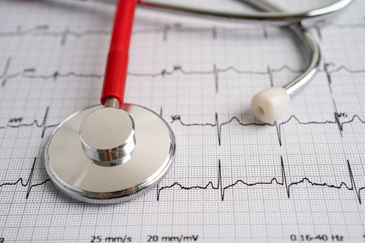 Emergency Care for Heart Attacks: What to Do?