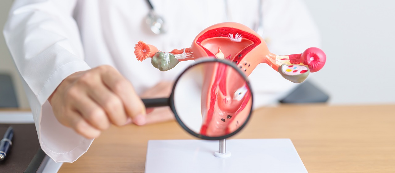 Can polycystic ovary patients get pregnant?