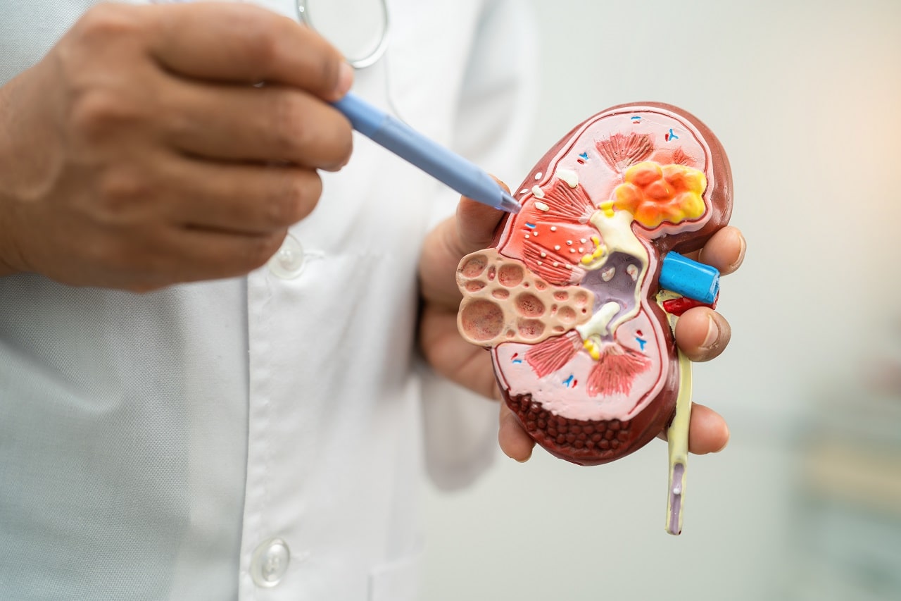 How is a kidney transplant performed? All About Kidney Transplant