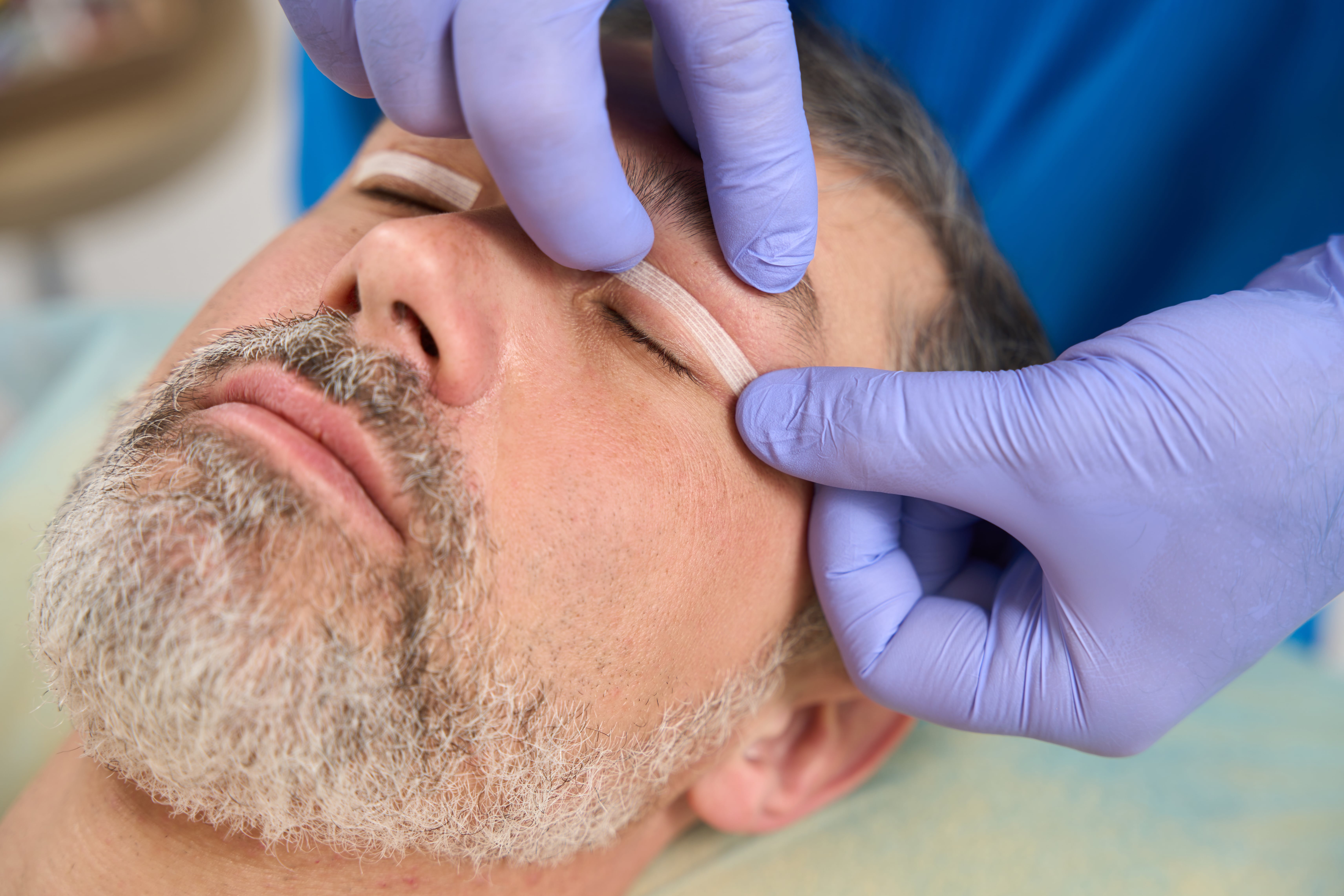 Why is Eyelid Surgery Done?