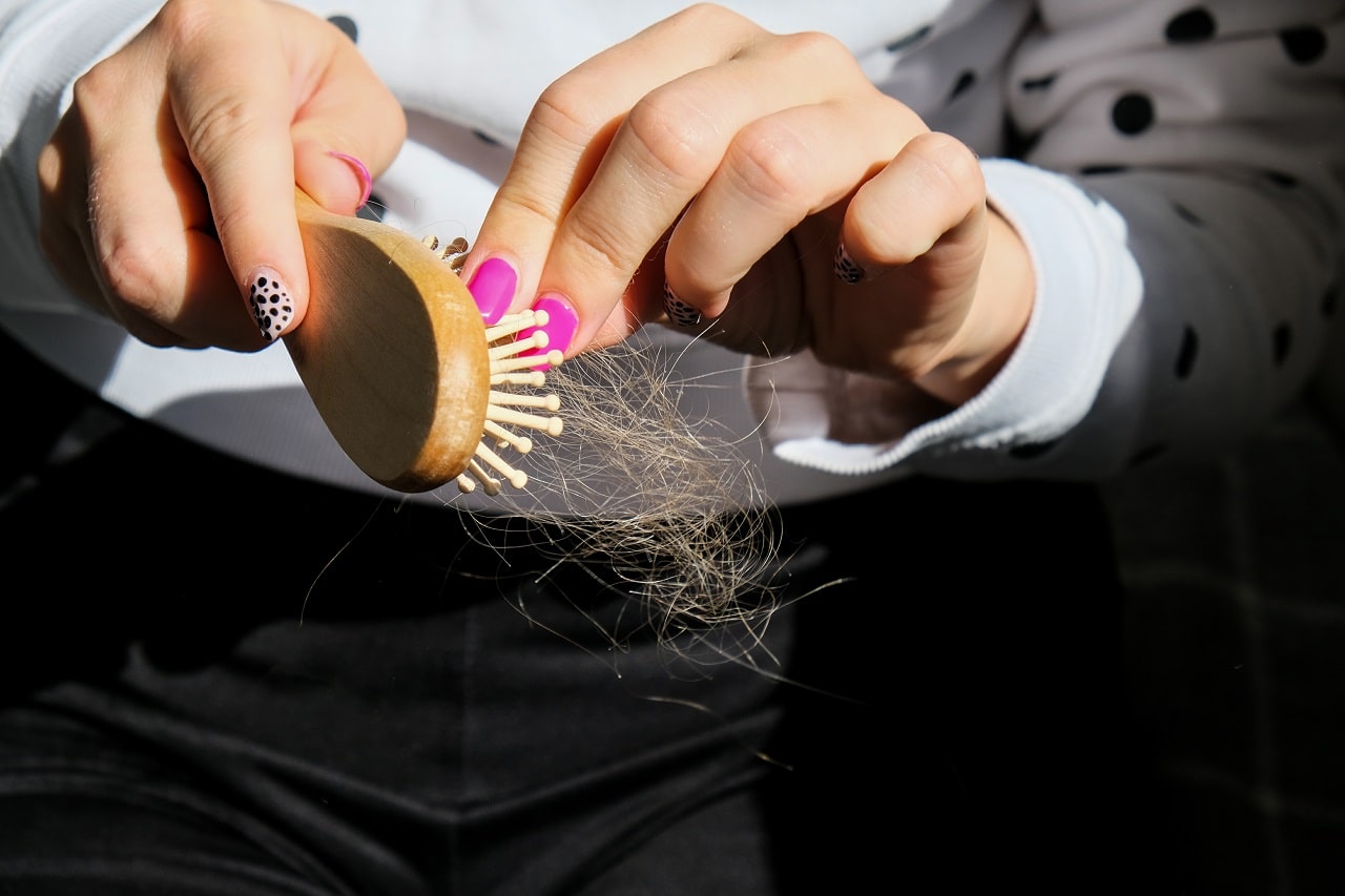 Hair Loss During Pregnancy and Its Treatment