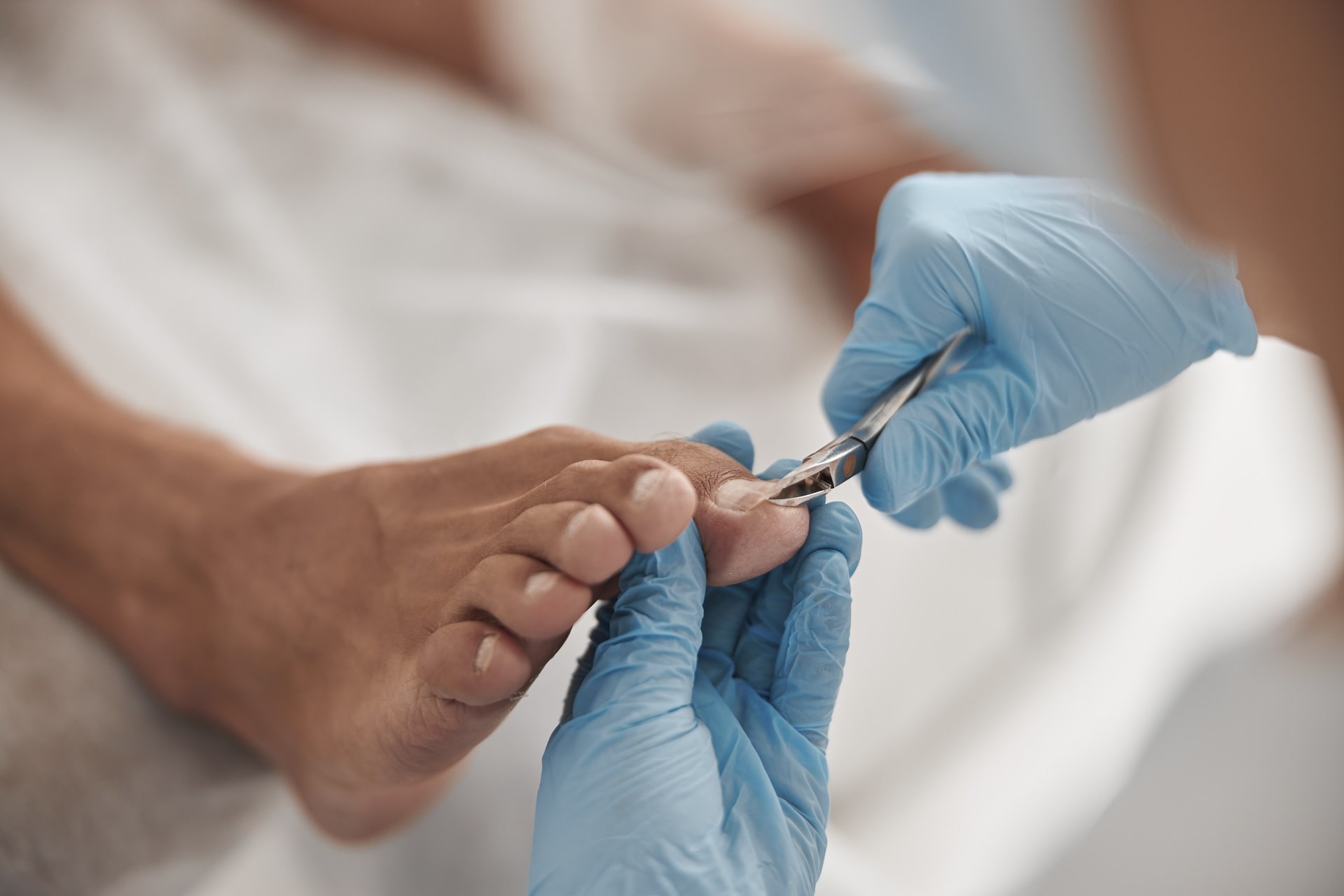 What is Ingrown Nail? What are the Symptoms? 