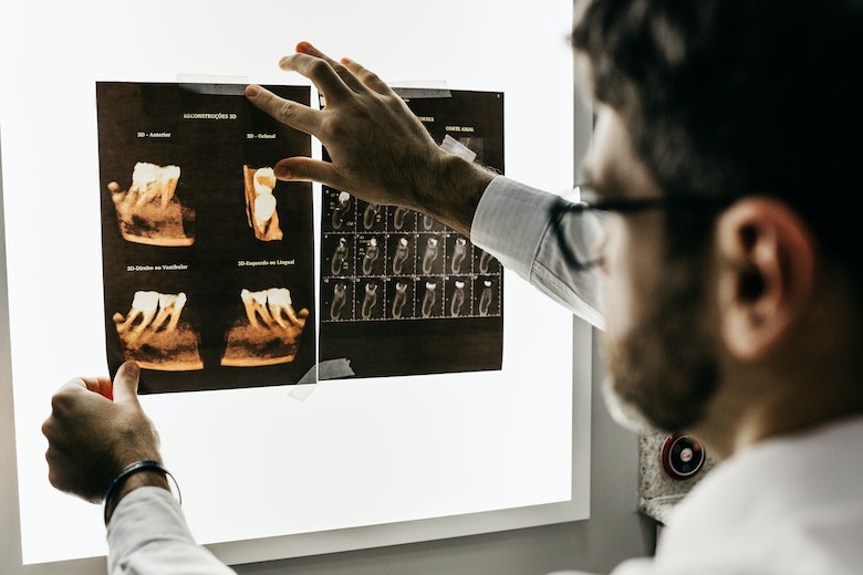10 Things to Consider After Dental Treatments