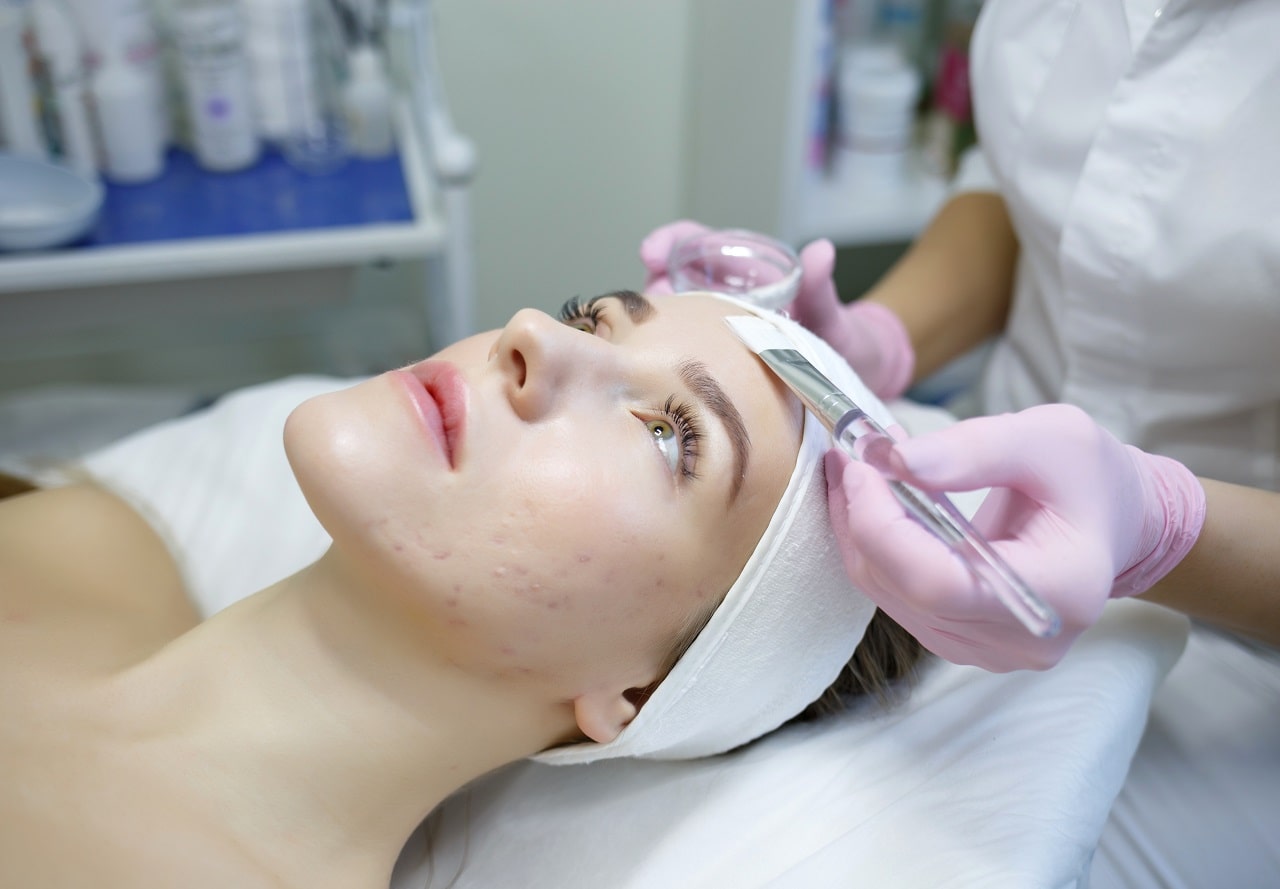 What is Acne? Why Does It Happen? How is The Treatment Going?