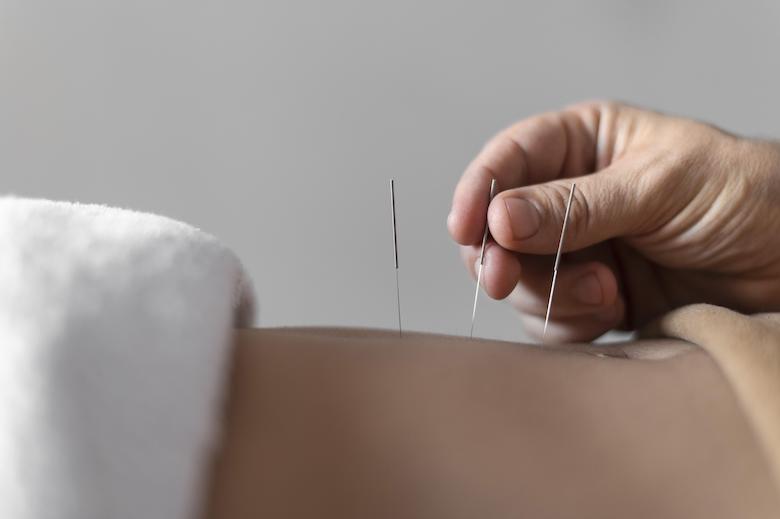What is Complementary Medicine? What are Complementary Medicine Practices in Turkey?