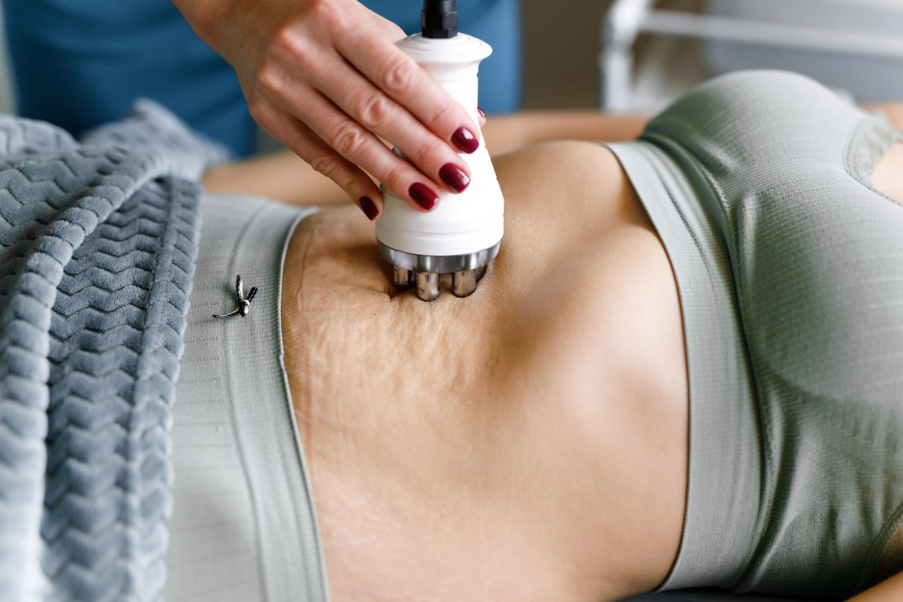 What is regional slimming and cellulite treatment? How was it?