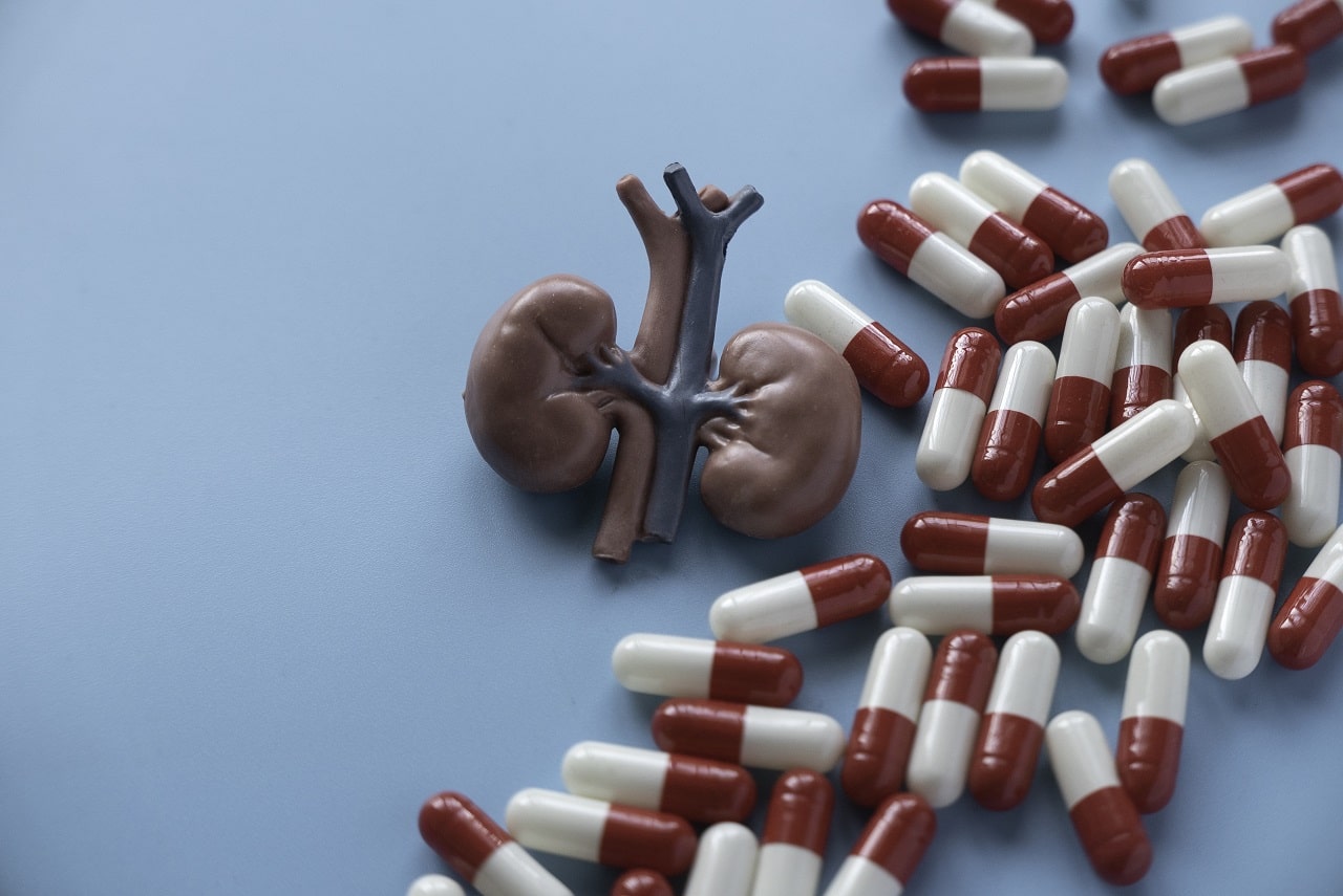 Dealing with Kidney Stones: Symptoms, Diagnosis and Treatment